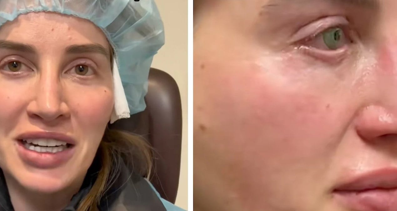 9 milyon kisi bu gozleri konusuyor kalici olarak yaptirdi gorenler dondu kaldi BwmWXUM9